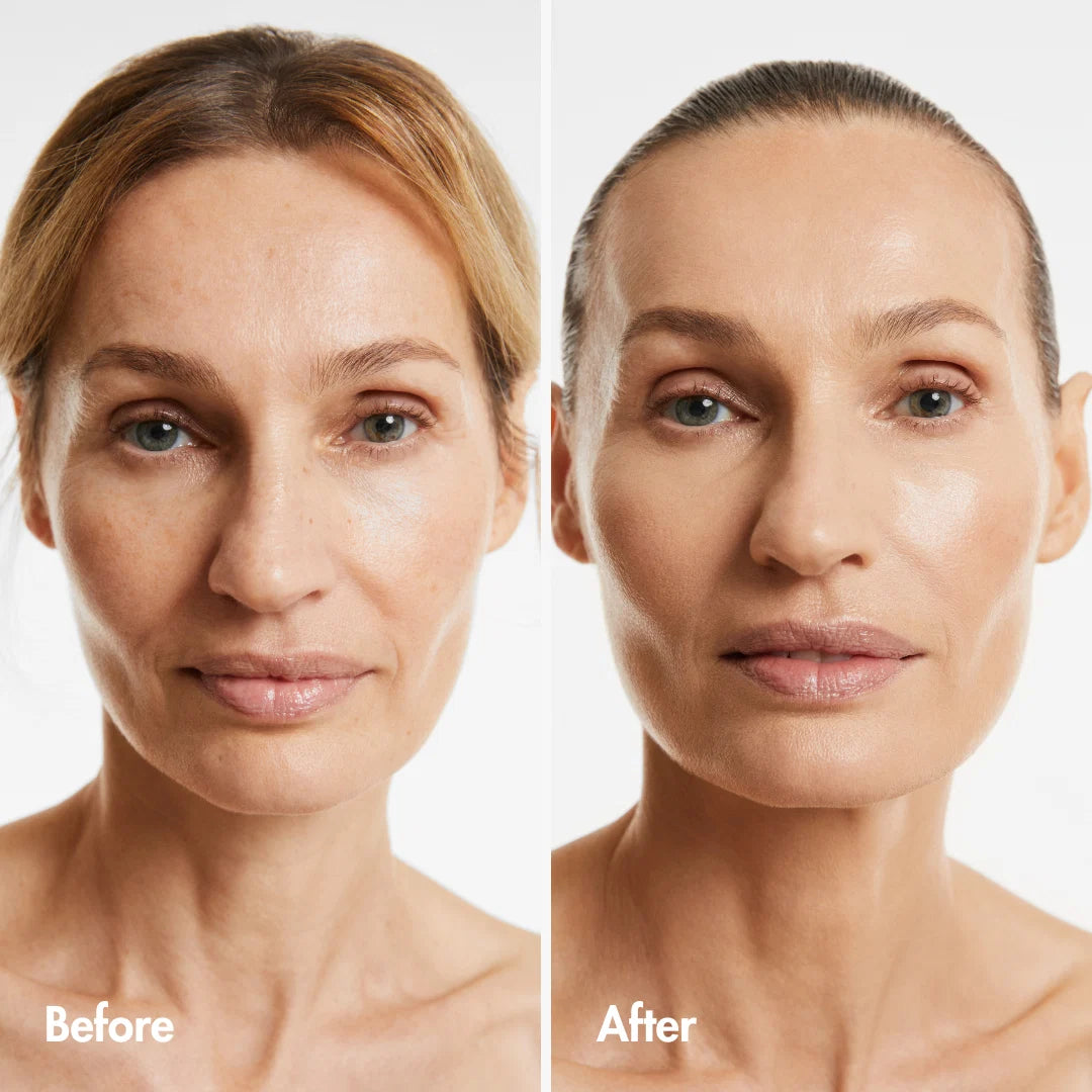 Before and after comparison